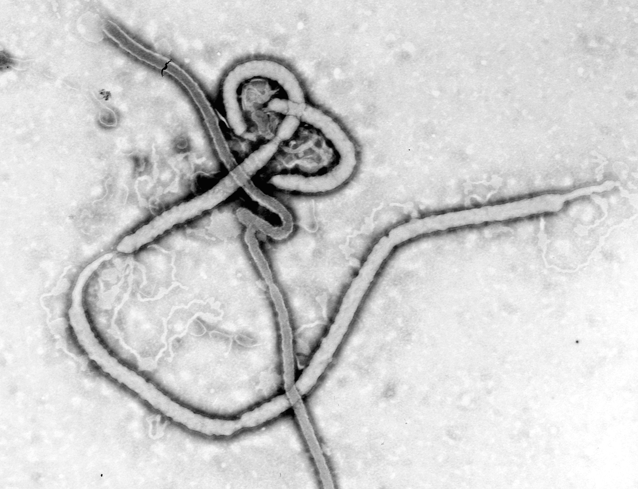 Why You Shouldn't Be Afraid of Ebola in the US - Center for Disease Dynamics, Economics & Policy (CDDEP)